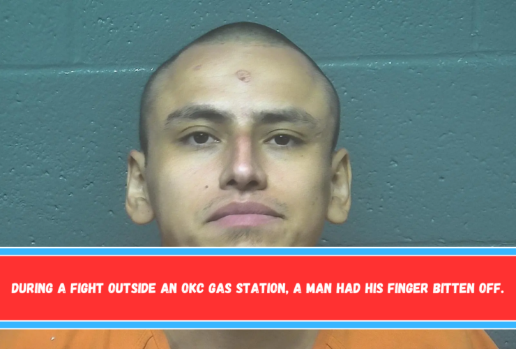 During a fight outside an OKC gas station, a man had his finger bitten off.